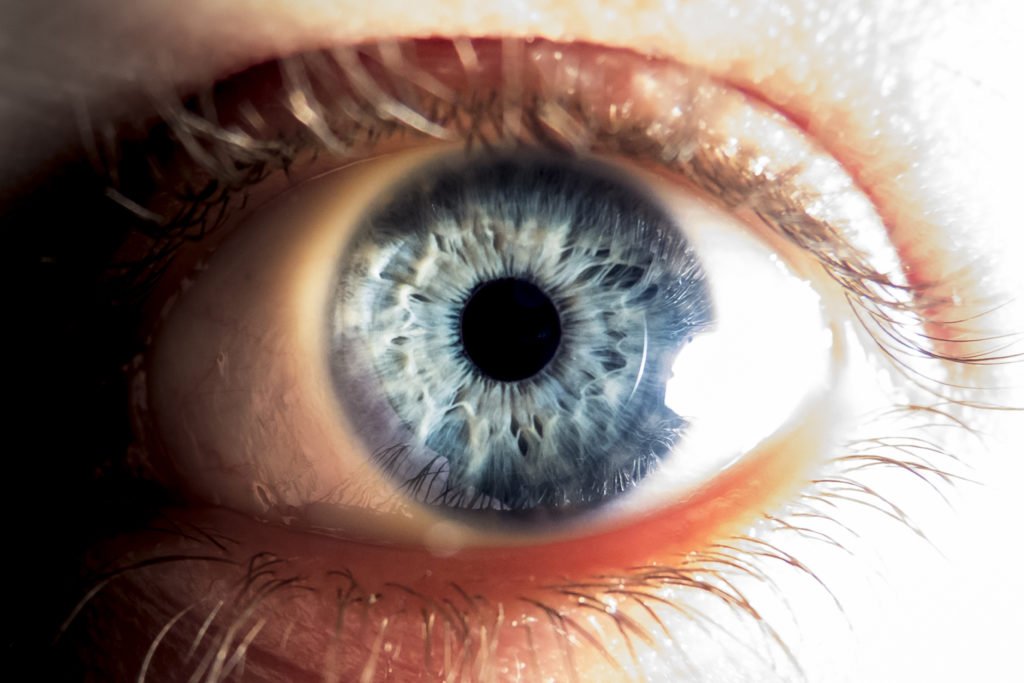 lentilles