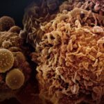 découvrez la vérité sur les idées fausses courantes liées au cancer et informez-vous correctement pour mieux comprendre cette maladie complexe.