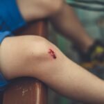 découvrez tout ce qu'il faut savoir sur les blessures : types, causes, traitements et conseils pour une récupération efficace.